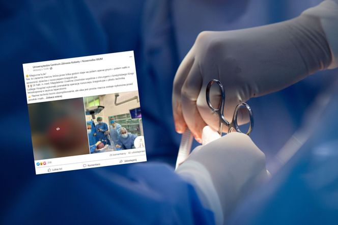 Magiczna kula? Nie, to ciężarna macica. Niezwykła operacja w Warszawie