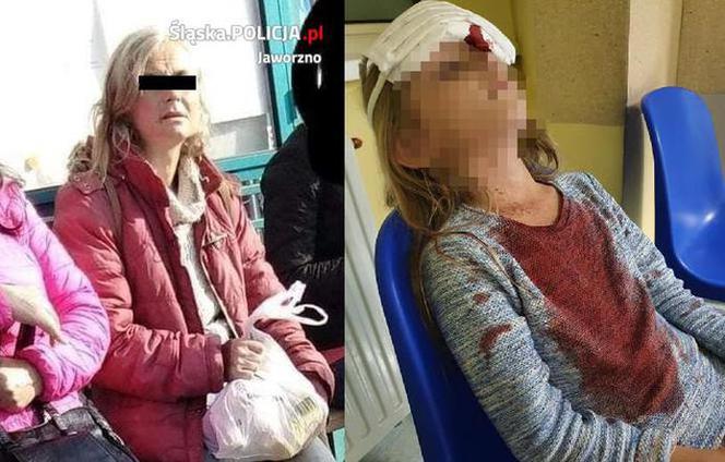 Bezdomna rzuciła kostką brukową w głowę Oliwki