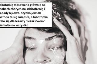 W tych przypadkach stosowano lobotomię