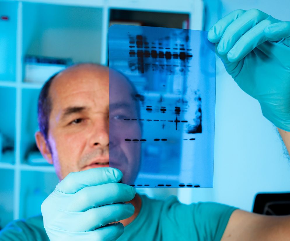 Test Western Blot a borelioza. Interpretacja wyników badania