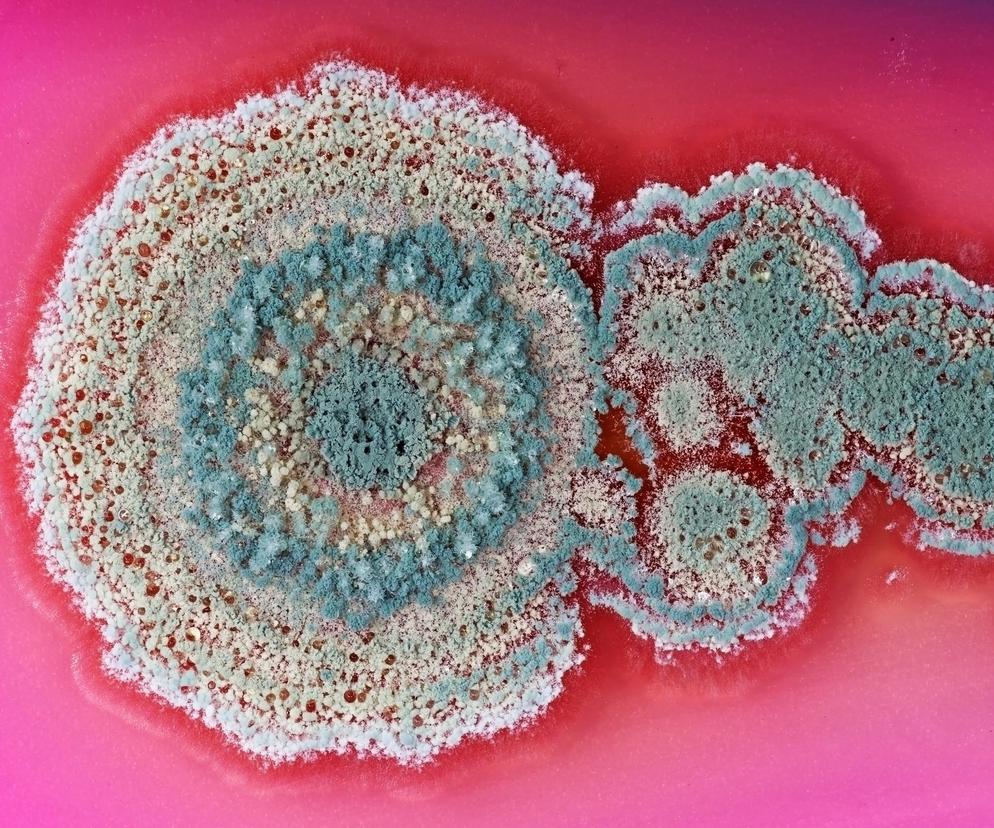 Lekooporny grzyb naprawdę może zagrozić ludzkości. WHO i CDC ostrzegają świat