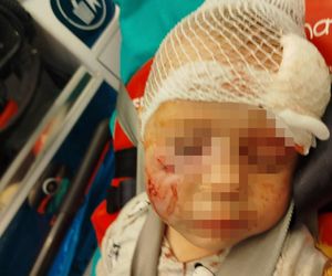 Pies pogryzł 3-latka na przystanku