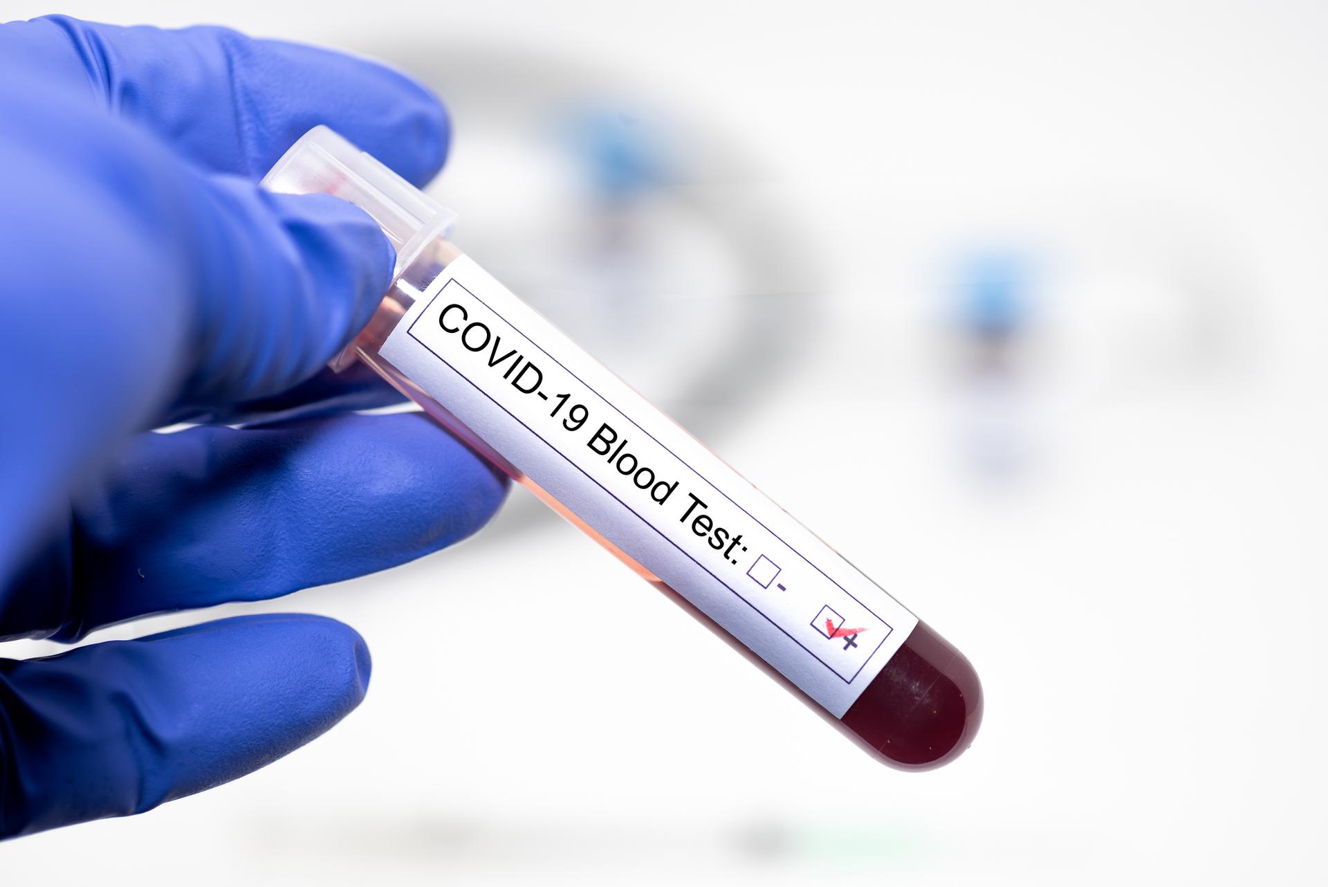 test wymazowy na koronawirusa