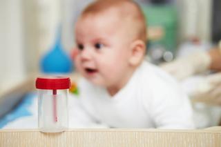 Badanie moczu niemowlaka. Jak pobrać próbkę moczu od dziecka?