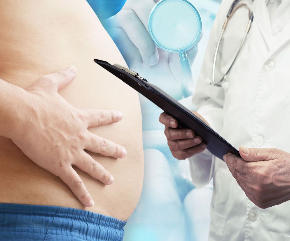 Jesteś otyły? Jak traktują cię w służbie zdrowia? Weź udział w badaniu!