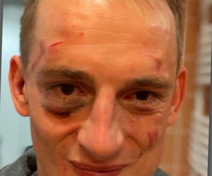 Jaś Kapela pokazał zmasakrowaną twarz po PRIME MMA 2