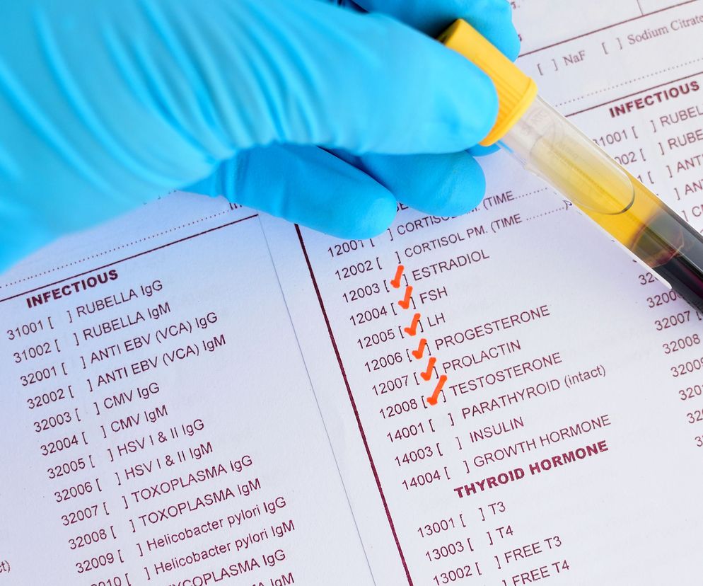 Hiperprolaktynemia dotyka przeważnie kobiety.