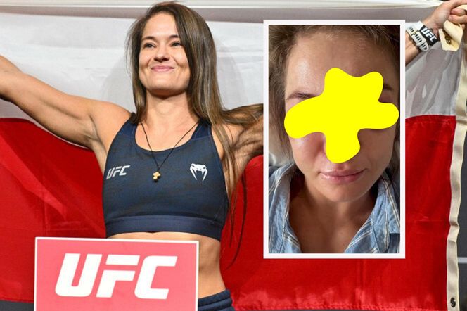 Polka brutalnie rozbita na UFC. Karolina Kowalkiewicz pokazała twarz po przyjęciu 142 ciosów