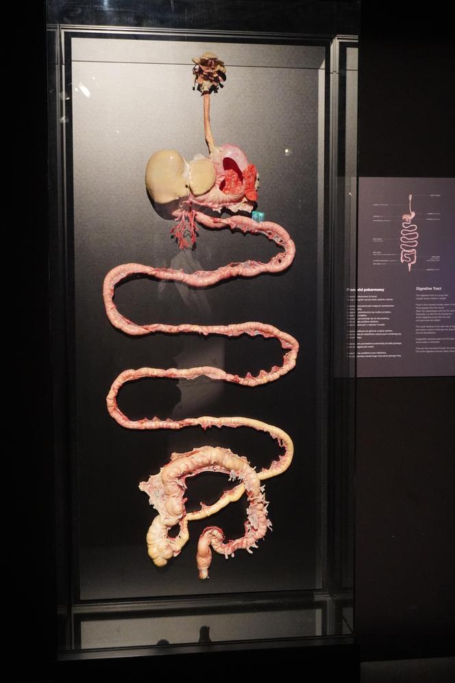 Wystawa z ludzkiego ciała. Body Worlds powróciła do Gdańska po 5 latach 