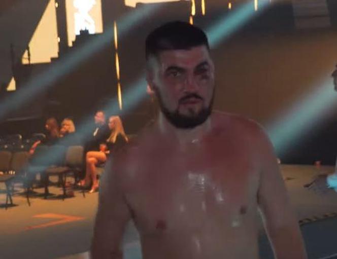Potężnie zmasakrowana twarz Don Kasjo po walce. Odwracaliśmy wzrok od tych zdjęć. Potworne obrazki