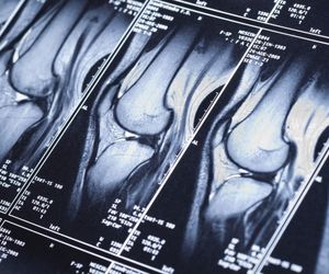 ŁĄKOTKA - kiedy usunąć a kiedy zastąpić IMPLANTEM