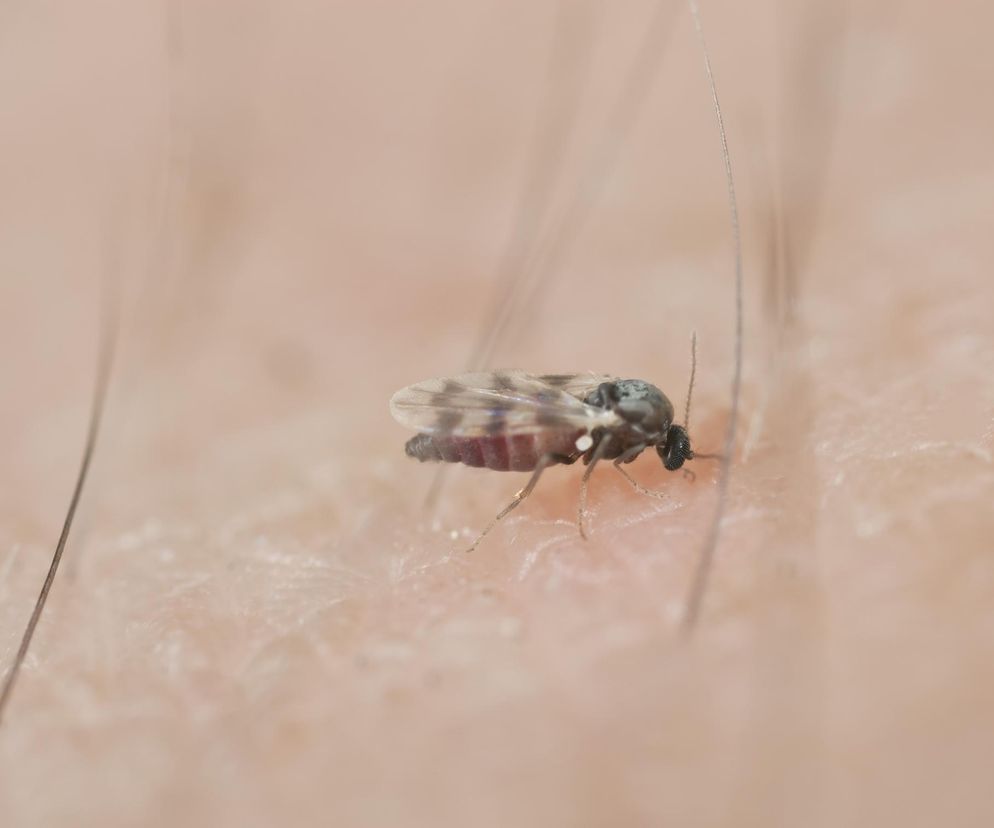 Ugryzienia meszek - jak je leczyć? Sprawdzone sposoby na ukąszenia meszek