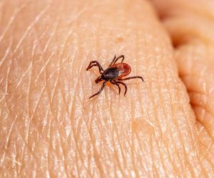 Rumień wędrujący to jeden z pierwszych i najbardziej rozpoznawalnych objawów boreliozy