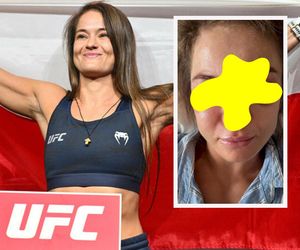 Polka brutalnie rozbita na UFC. Karolina Kowalkiewicz pokazała twarz po przyjęciu 142 ciosów