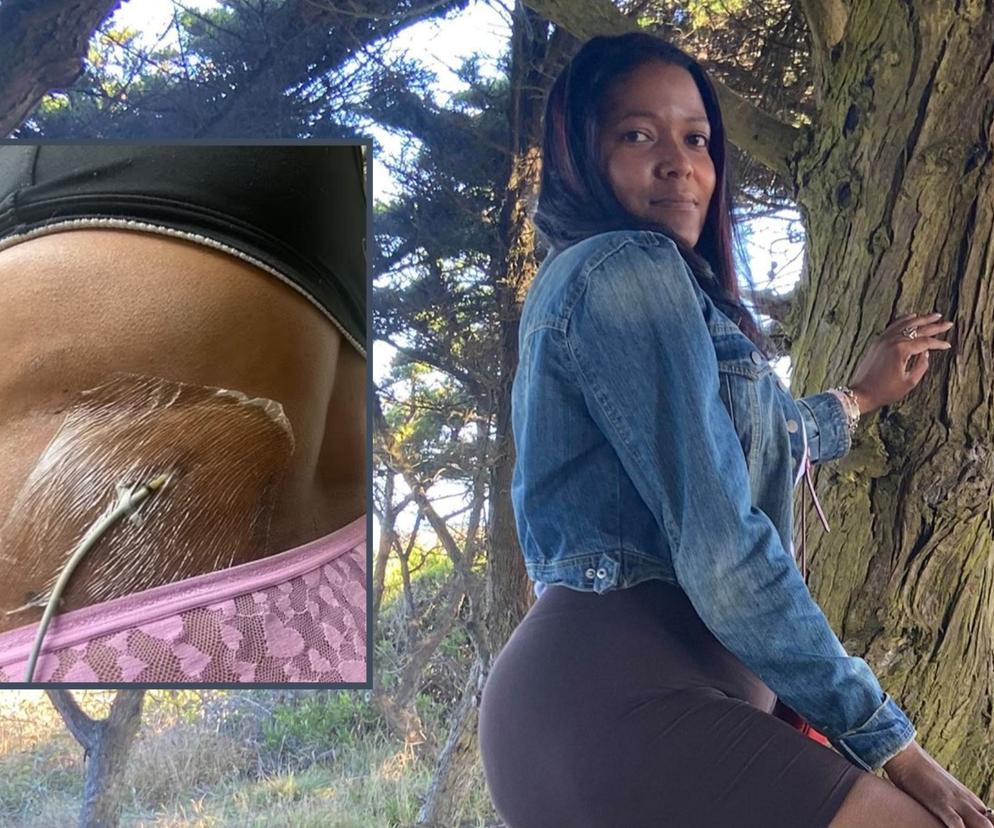 Miała na jajnikach cysty wielkości grejpfruta. Ból pozbawił mnie pracy