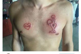 Tatuaże z henny mogą zostawiać blizny! [FOTO]