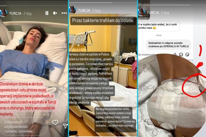 Relacja Pauliny po wizycie w tureckiej klinice na jej profilu na Instagramie