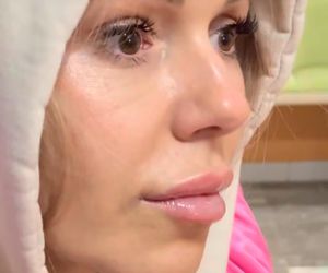 Doda pokazała bliznę po wycięciu czerniaka