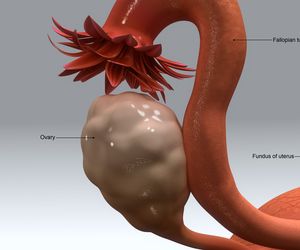Ropień jajnika, jajowodu: przyczyny, objawy, leczenie