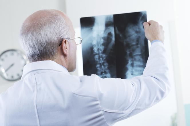 Osteoporoza: jakie badania pozwolą rozpoznać odwapnienie kości?