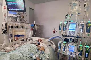 Polak walczy o życie po zderzeniu z koniem