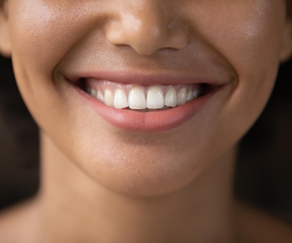 Wybielasz zęby tą metodą? Eksperci mają złą wiadomość 