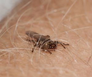 Strzyżak jeleni (sarni). Latające kleszcze - objawy ukąszenia przez kleszcza ze skrzydłami