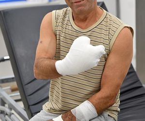 W 5 Klinicznym Szpitalu Wojskowym  Krakowie przyszyli panu Markowi kciuk