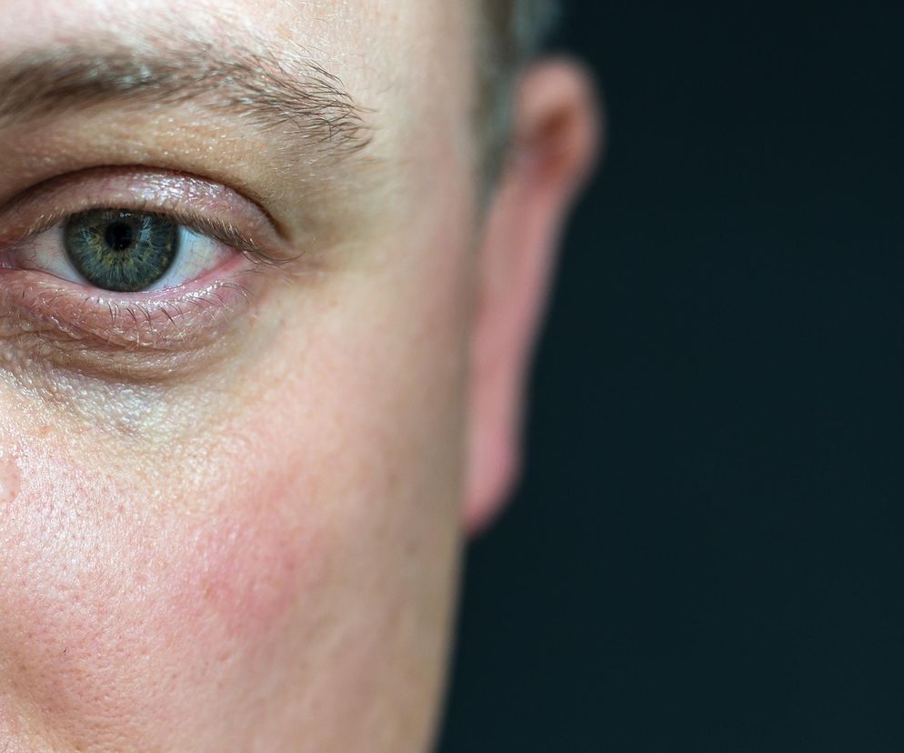 Jak się przenosi HIV? Polacy nie wiedzą, że mogą być zakażeni