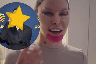 Julia von Stein ruszyła na ściankę pierwszy raz po liftingu. Było warto? Sami oceńcie [ZDJĘCIA] 