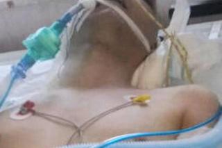 Mateusz z Raczek przeżył wypadek samochodowy. Czeka go długotrwałą rehabilitacja. Mama 22-latka: Z całego serca proszę o pomoc!