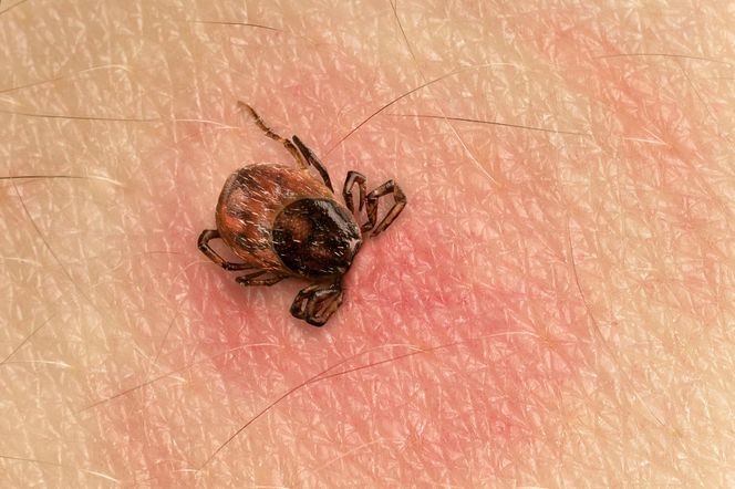 Odkryto nowy sposób na kleszcze. Jest naturalny i super skuteczny