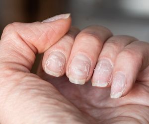 Wsmaruj wieczorem w swoje zniszczone hybrydą paznokcie. Zapomnisz o łamiącej się płytce. Paznokcie będą twarde jak kiedyś. Odżywka do paznokci po manicure hybrydowym