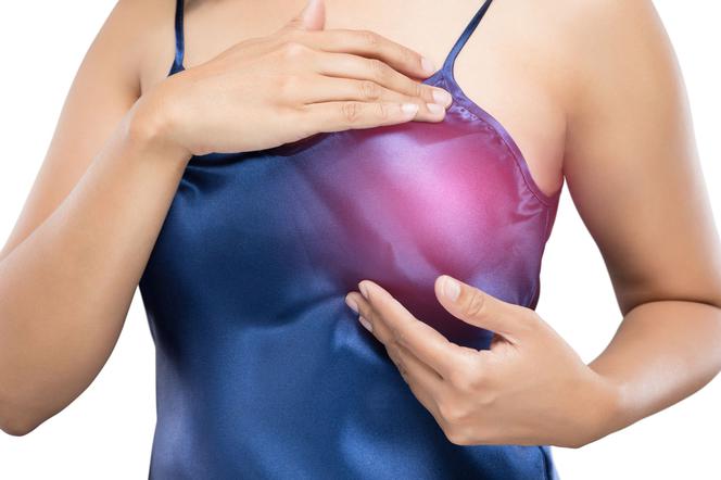 Zapalenie piersi: przyczyny, objawy, leczenie