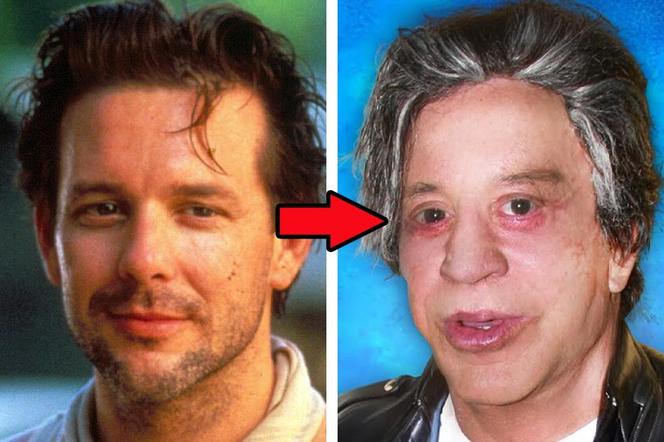 Mickey Rourke