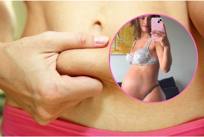 4 miesiące po porodzie pokazała brzuch. Oskarżyli ją o czary