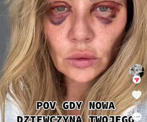 Jenningsowie kontra Alzheimer (BBC Earth)