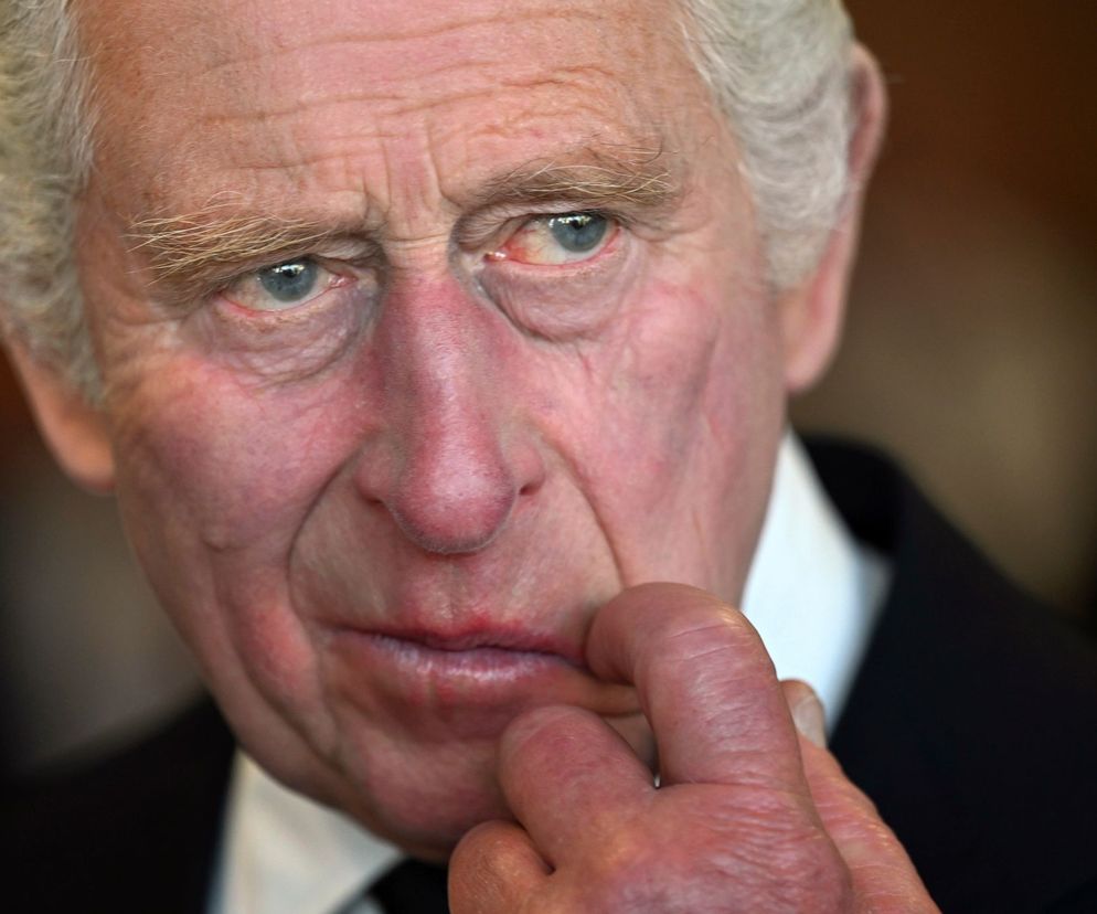 Koronacja króla Karola III. Stan zdrowia monarchy budzi ogromny niepokój