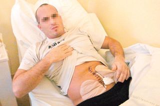 Wojna agencji ochroniarskich w Łodzi