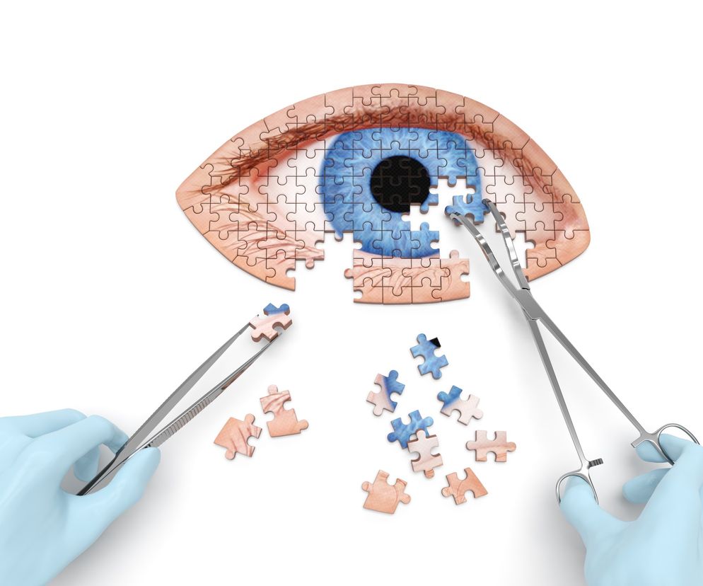 Zaćma - jakie soczewki wybrać? Rodzaje soczewek przy zaćmie