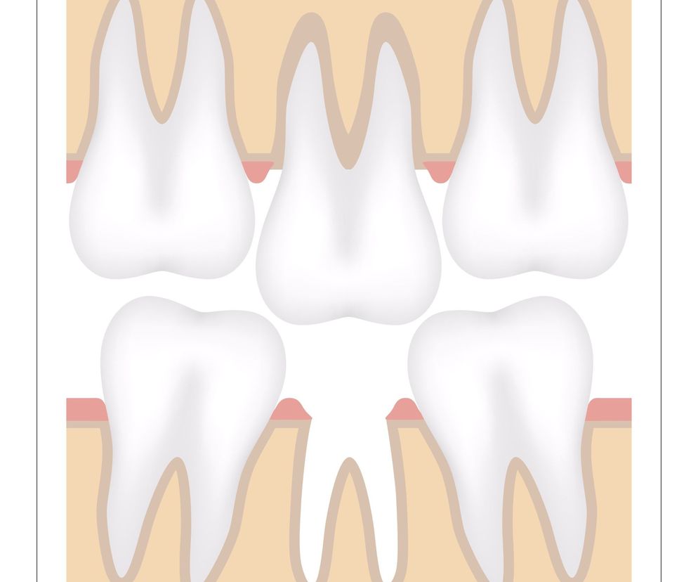Efekt Godona - przyczyny i leczenie objawu Godona
