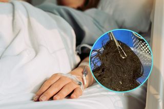 To wyjęli z żołądka 17-latki. Okazało się, że cierpi na zespół Roszpunki 