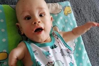 3-letni Adaś walczy o zdrowie. Obydwie dłonie są szczątkowe i brakuje palców