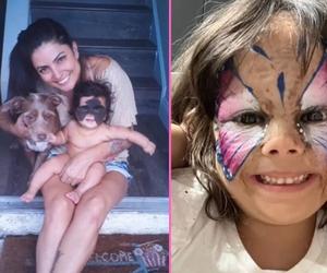 Czterolatka przeszła 6 operacji, aby pozbyć się maski Batmana. Dziś wygląda jak księżniczka