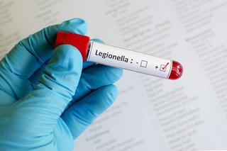 Legionella wkrótce znowu uderzy? Polskie przepisy na to pozwalają