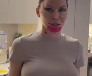 Julia von Stein po operacji