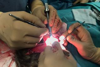 Przyszyli 7-latce skalp. Operacja trwała 7 godzin!