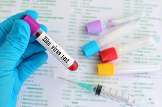 Wirus zika - testy są już dostępne w Polsce
