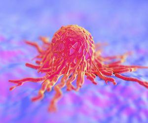 Rak brodawki Vatera - objawy, leczenie, rokowania