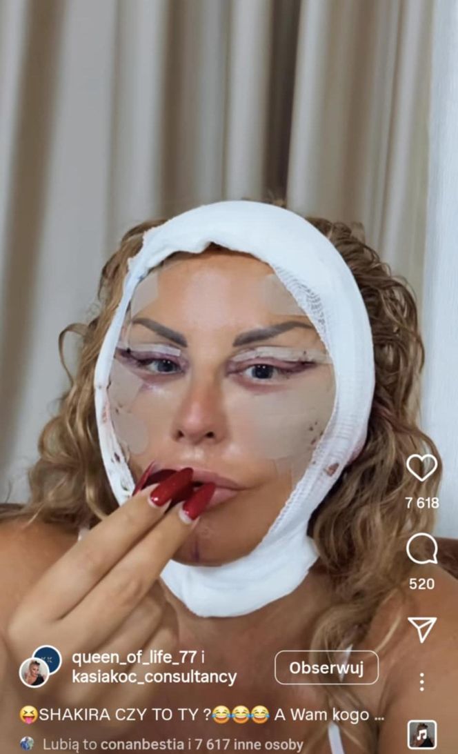 Dagmara Kaźmierska miała operację plastyczną